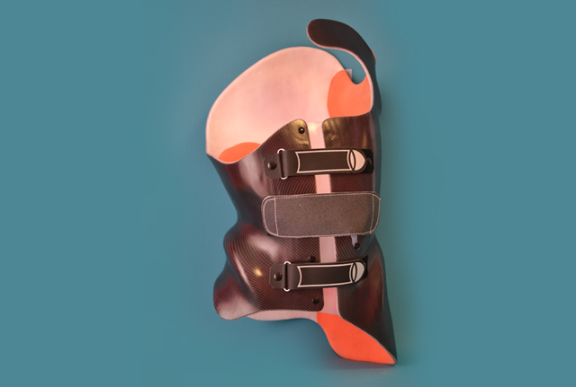 orthopedie ORTHOPEDIE orthopedique ORTHOPEDIQUE orthese ORTHESE sport orthopedie generale RAVIER TOUZARD